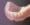 dentures weymouth ma