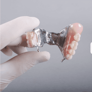 bad dentures