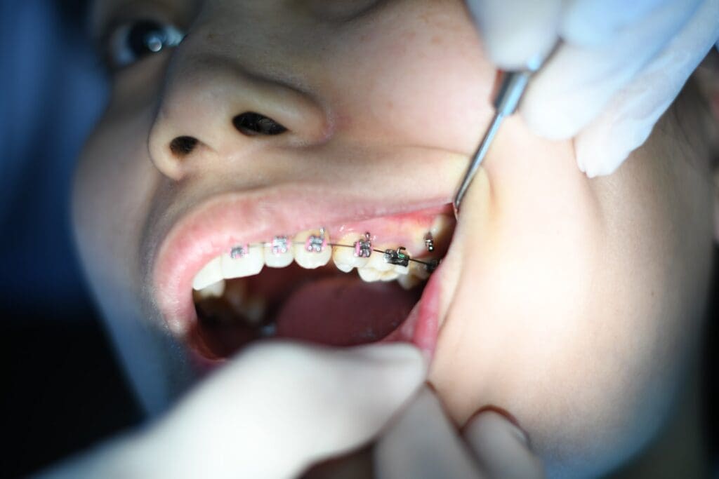Dental Emergencies