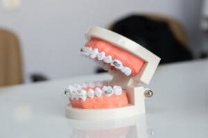 Dental