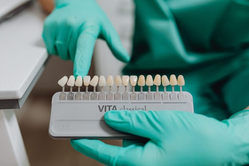 teeth whitening