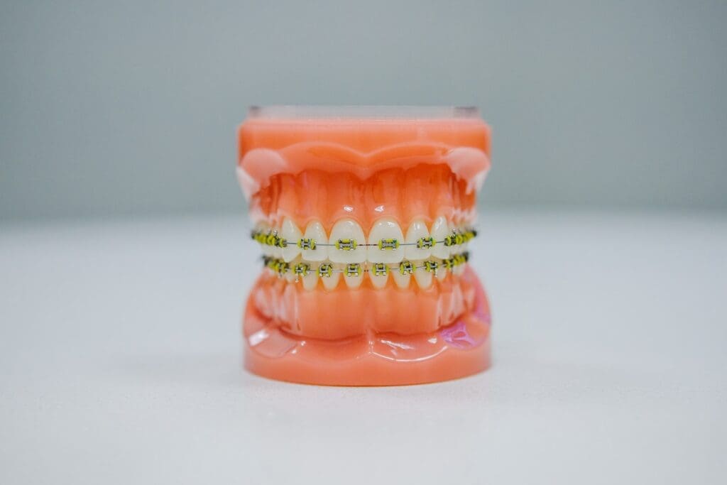 Dentures