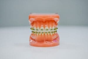 Dentures