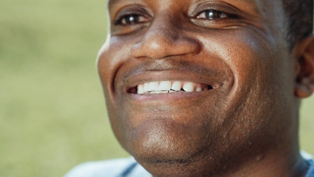 man with white teeth