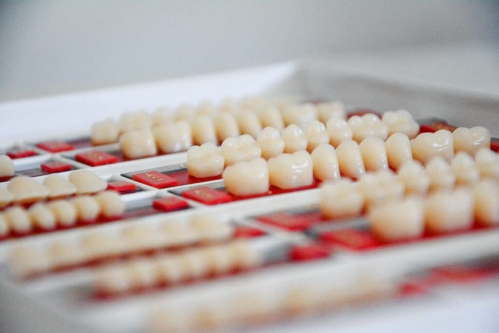 Veneers