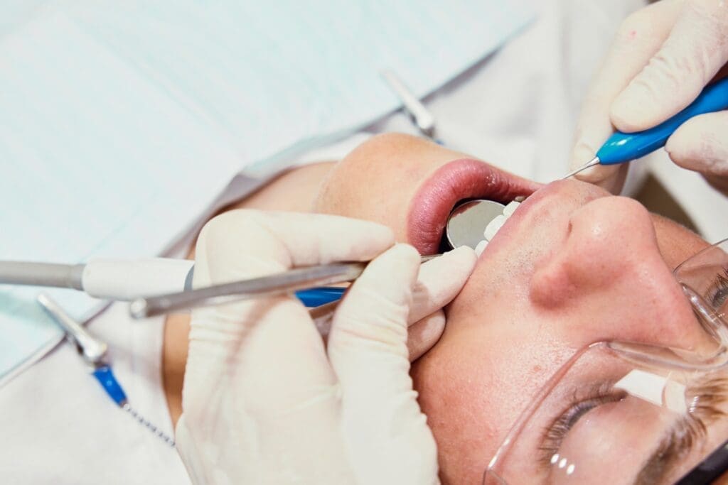 Dental Bonding
