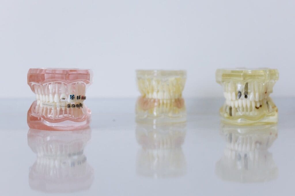 Dentures