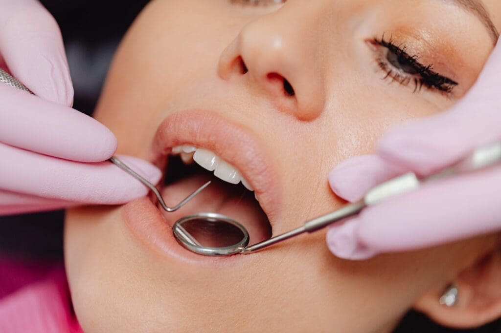 Teeth Whitening