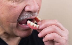 denture