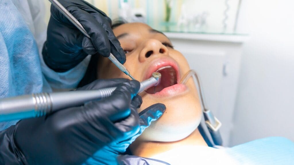root canal