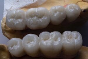 teeth