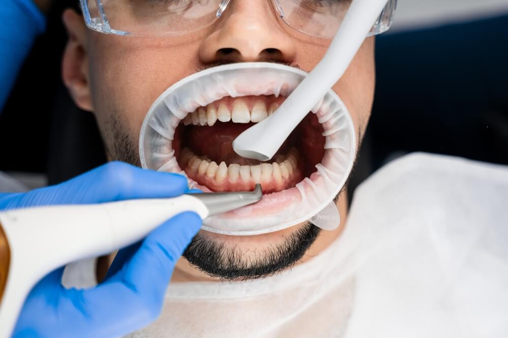 How Technology is Changing the Way We Approach Dental Cleanings?