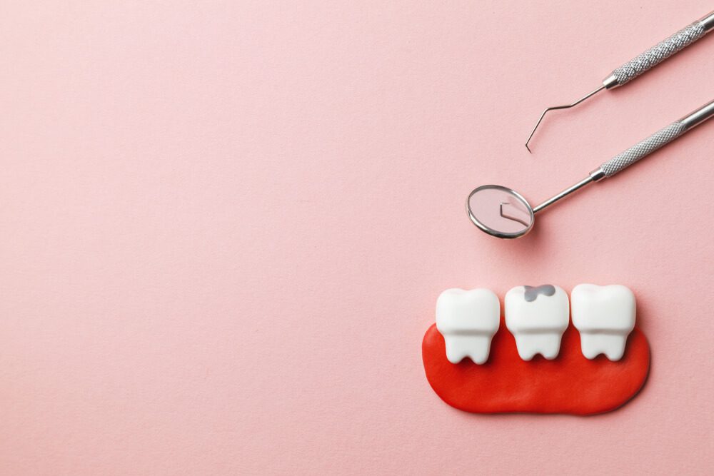 The Impact of Dental Fillings on Overall Oral Health