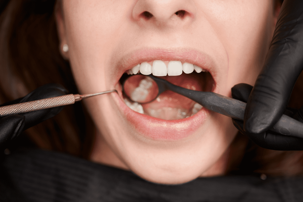 Looking for dental filling near me? Weymouth Dental Arts provides gentle and durable dental fillings in Weymouth to restore your smile. Book your appointment today!