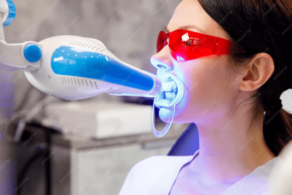 Fast, Safe, and Effective Laser Teeth Whitening