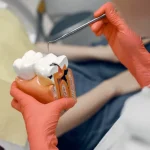 dentist showing a root canal treatment model to a patient