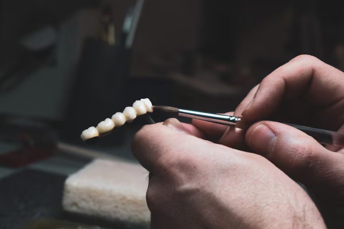 dentist creating a dental crown bridge for front teeth restoration